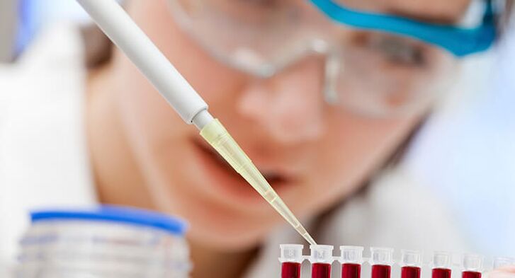 Diagnose der Arthrose des Hüftgelenks