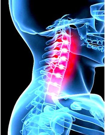 Klinisches Bild der Osteochondose